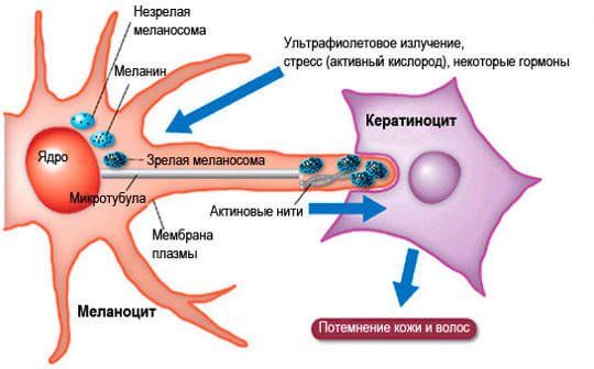 Чому з'являються родимки? Причини, що робити, фото і відео